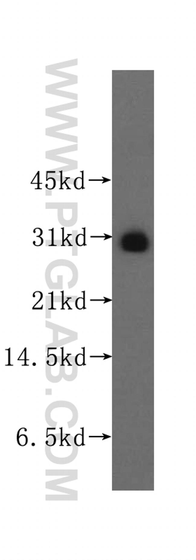 PPM1M Antibody in Western Blot (WB)