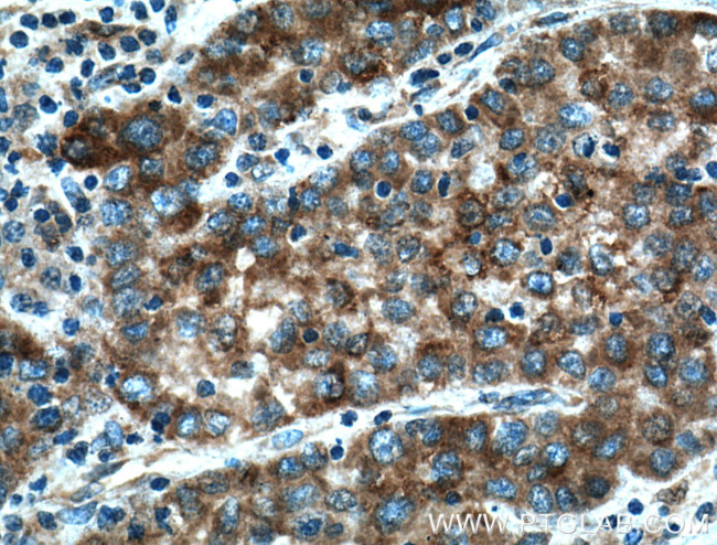 PTPN9 Antibody in Immunohistochemistry (Paraffin) (IHC (P))