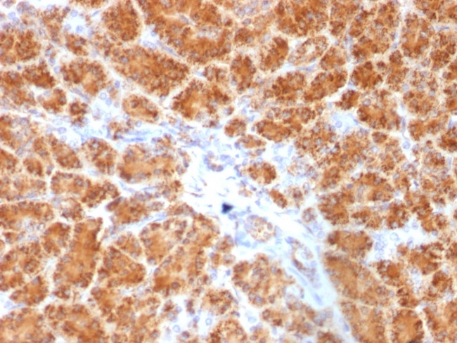 Clathrin, Light Chain Antibody in Immunohistochemistry (Paraffin) (IHC (P))