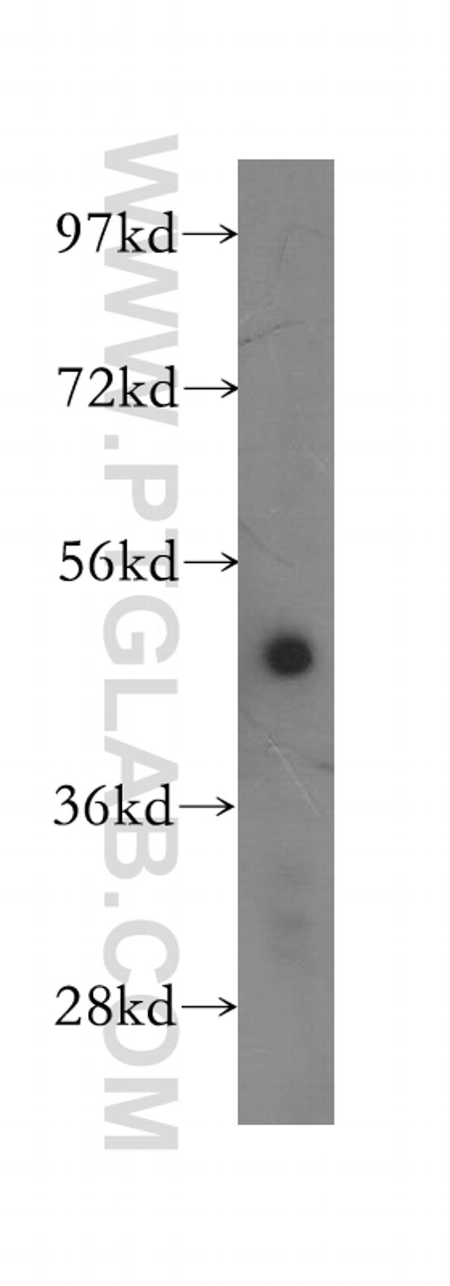 AP1M1 Antibody in Western Blot (WB)