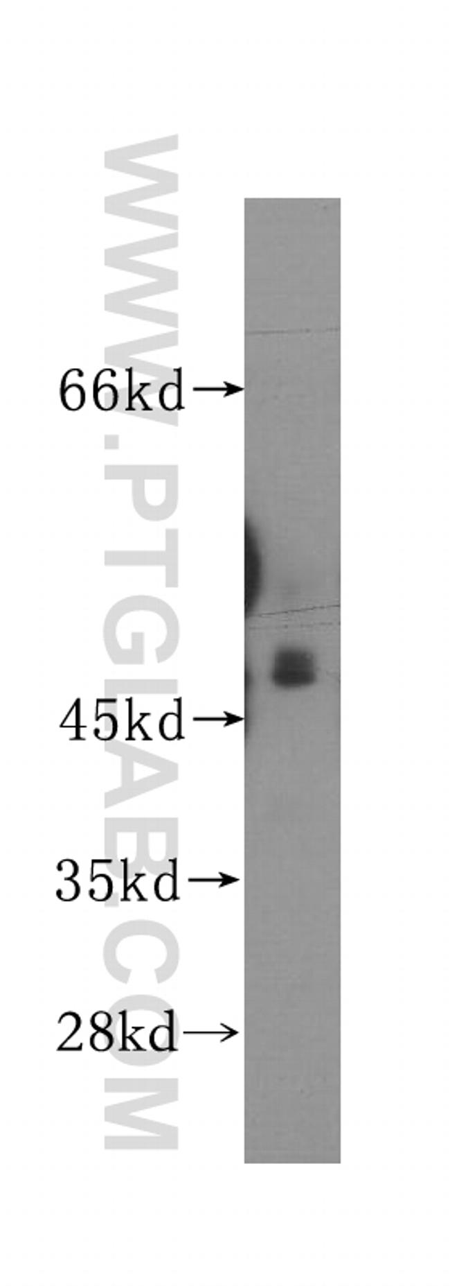 AP3M1 Antibody in Western Blot (WB)