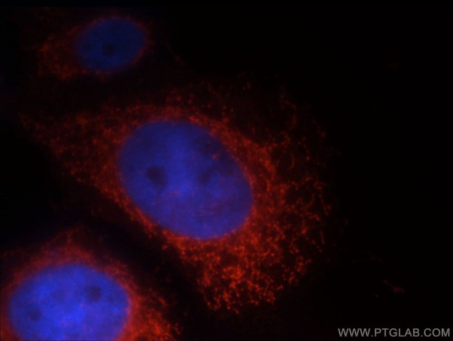 LRDD Antibody in Immunocytochemistry (ICC/IF)