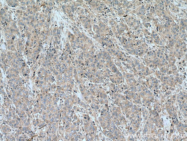 SLC16A5 Antibody in Immunohistochemistry (Paraffin) (IHC (P))