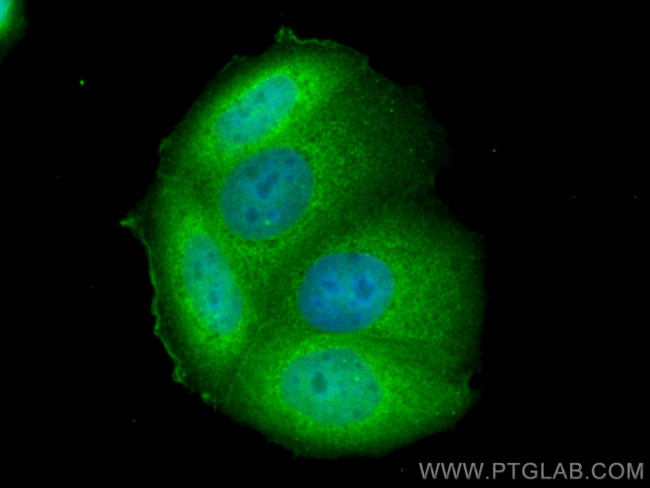 SNAI2 Antibody in Immunocytochemistry (ICC/IF)