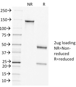 Clathrin, Heavy Chain Antibody in SDS-PAGE (SDS-PAGE)
