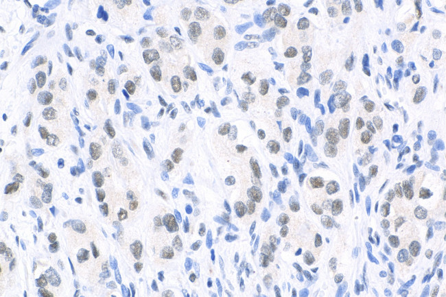 CREM Antibody in Immunohistochemistry (Paraffin) (IHC (P))