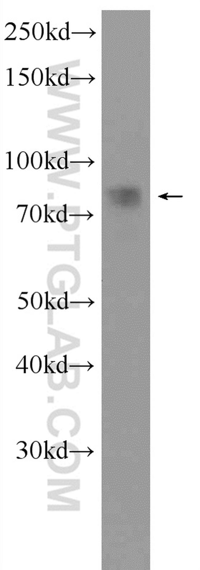 CIN85 Antibody in Western Blot (WB)