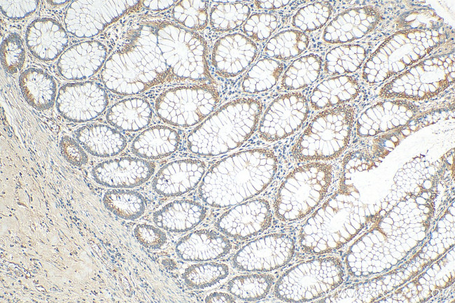 NXT2 Antibody in Immunohistochemistry (Paraffin) (IHC (P))