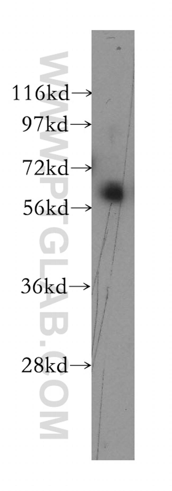 RFX5 Antibody in Western Blot (WB)