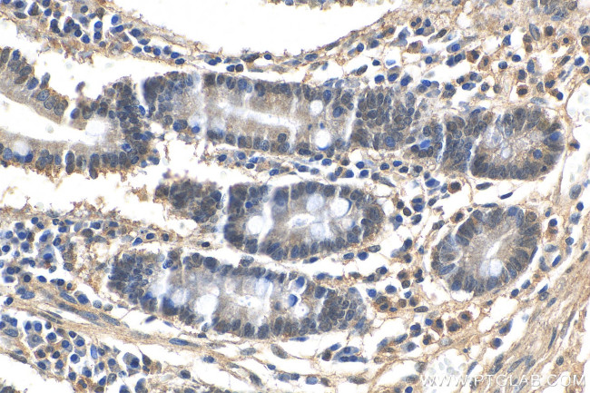 LSM6 Antibody in Immunohistochemistry (Paraffin) (IHC (P))