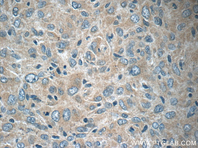 NCKAP1 Antibody in Immunohistochemistry (Paraffin) (IHC (P))