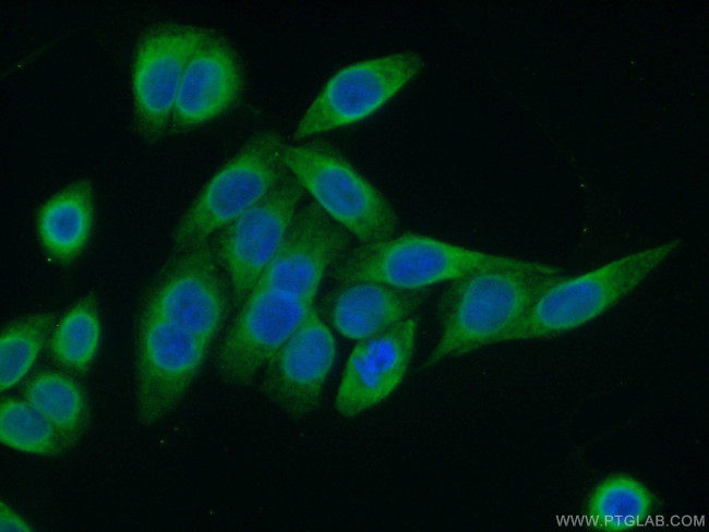 PRKCSH Antibody in Immunocytochemistry (ICC/IF)
