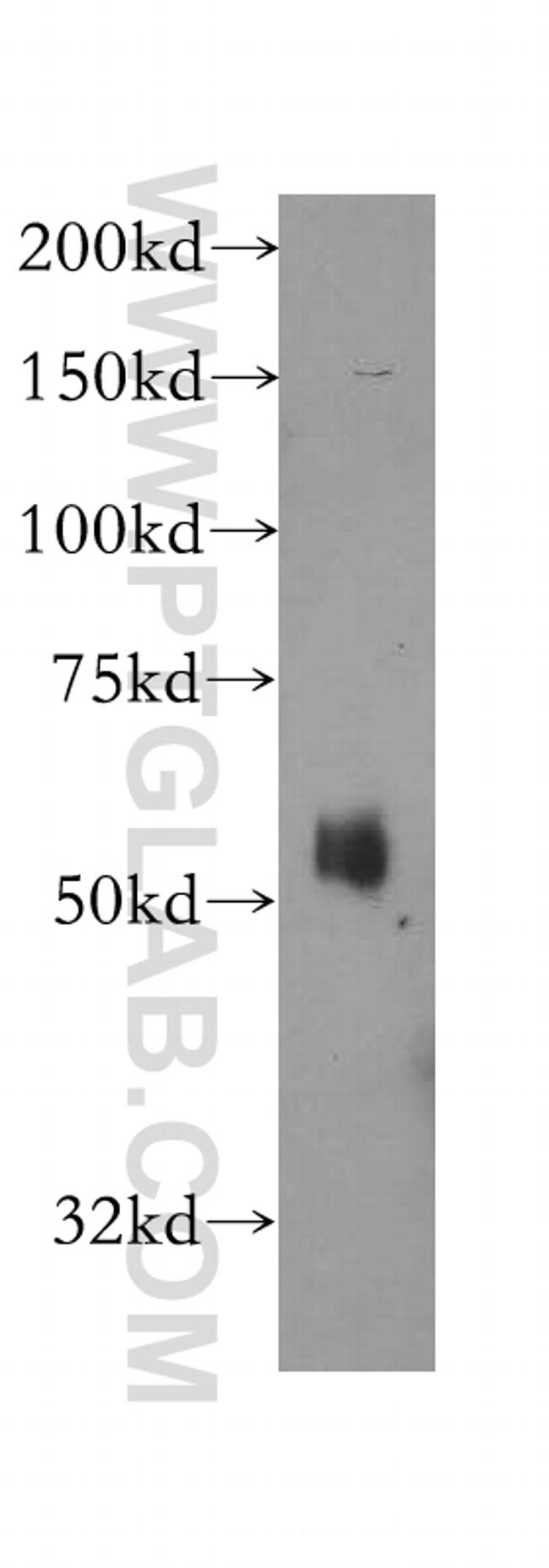 ATL1 Antibody in Western Blot (WB)