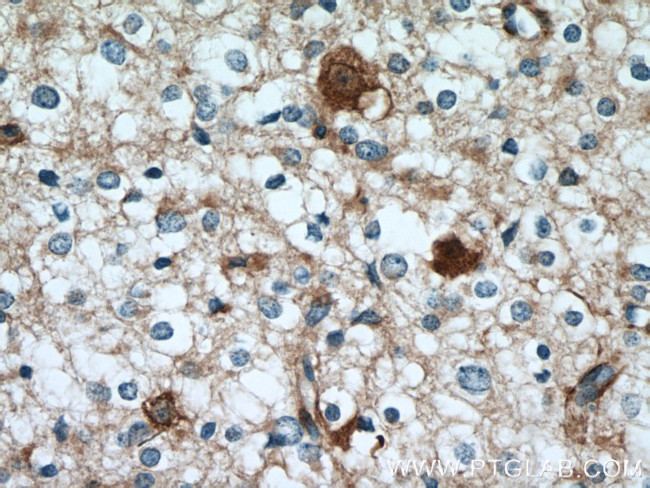 GPRASP2 Antibody in Immunohistochemistry (Paraffin) (IHC (P))