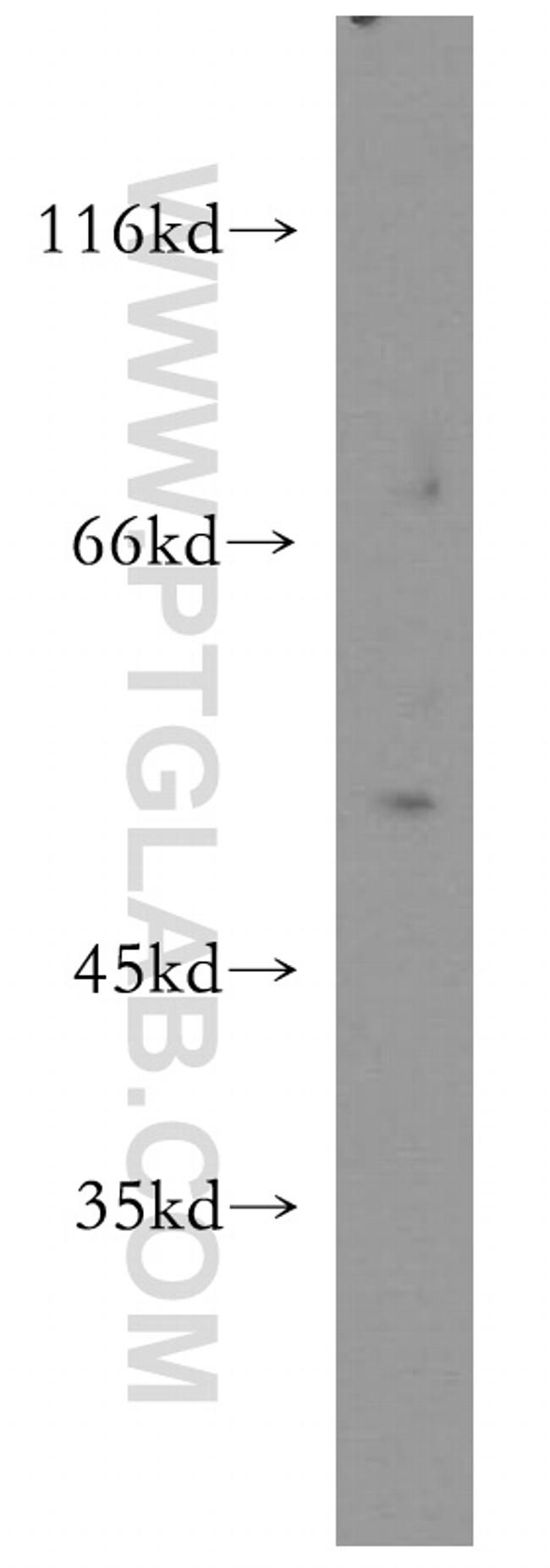 PAR2 Antibody in Western Blot (WB)