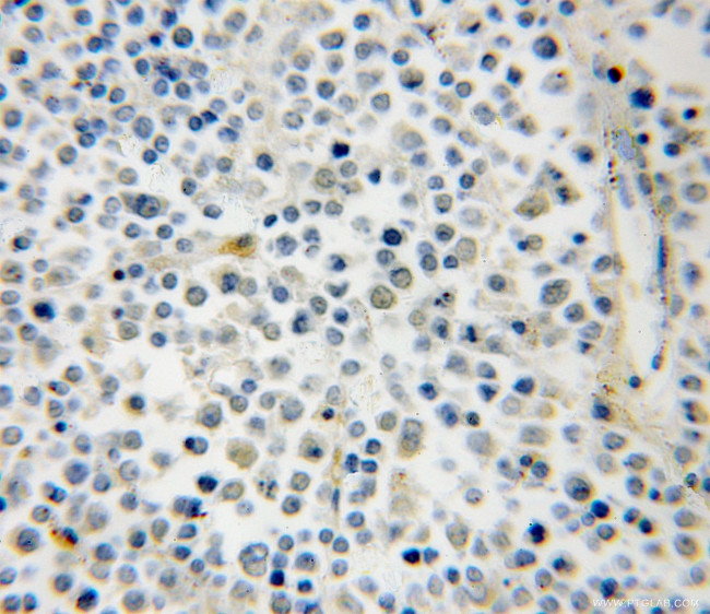 RAB39B Antibody in Immunohistochemistry (Paraffin) (IHC (P))