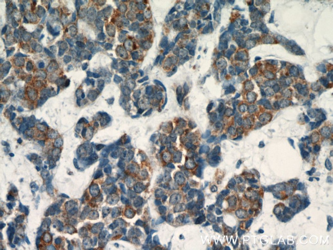 Dysadherin Antibody in Immunohistochemistry (Paraffin) (IHC (P))