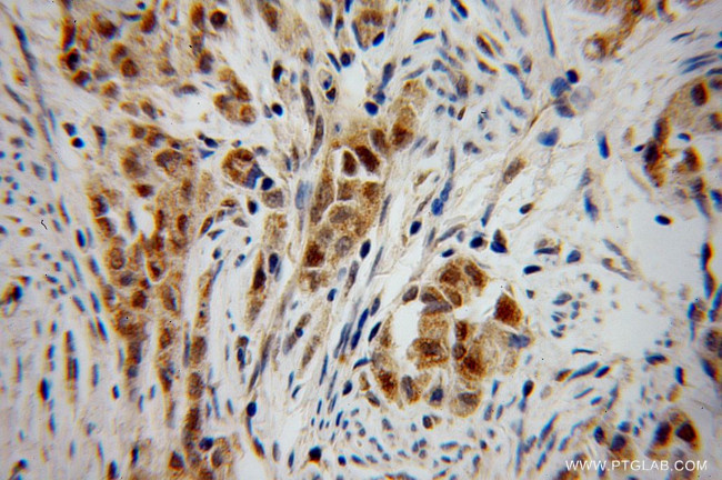 CHFR Antibody in Immunohistochemistry (Paraffin) (IHC (P))
