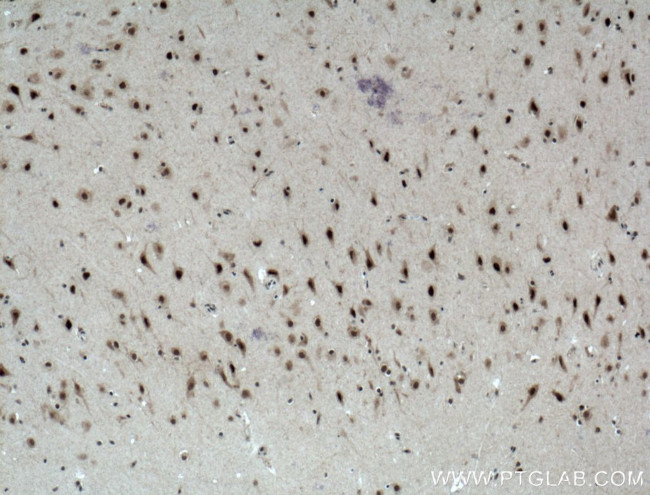 MED8 Antibody in Immunohistochemistry (Paraffin) (IHC (P))