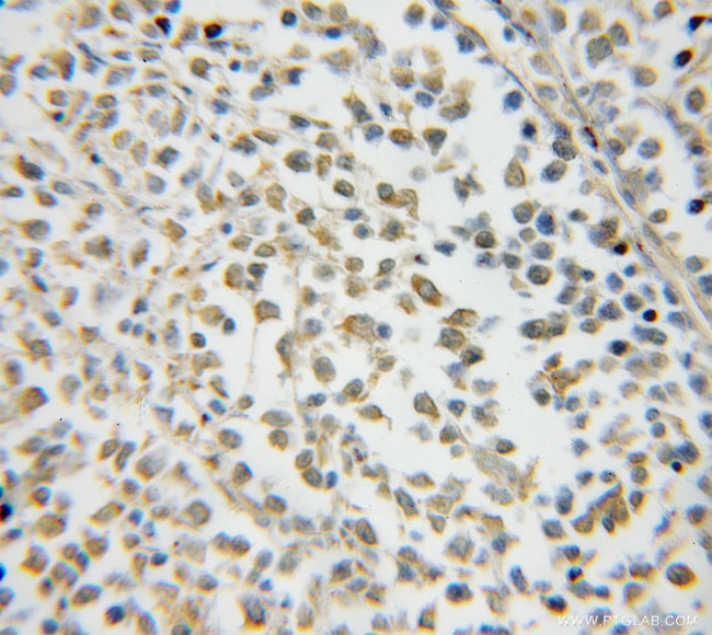 NXF2 Antibody in Immunohistochemistry (Paraffin) (IHC (P))