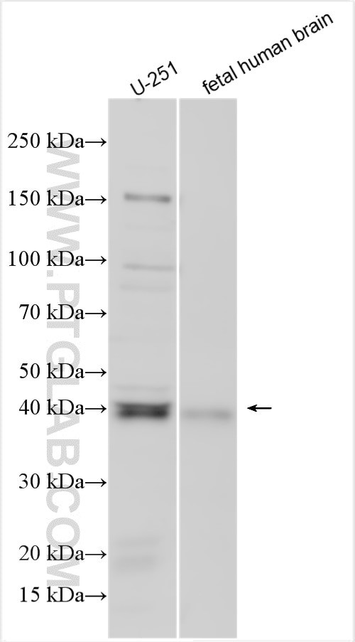 ITM2B Antibody in Western Blot (WB)