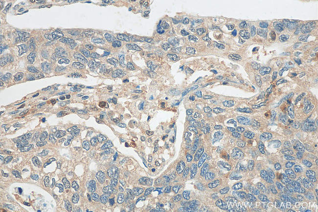 SH3BGRL3 Antibody in Immunohistochemistry (Paraffin) (IHC (P))