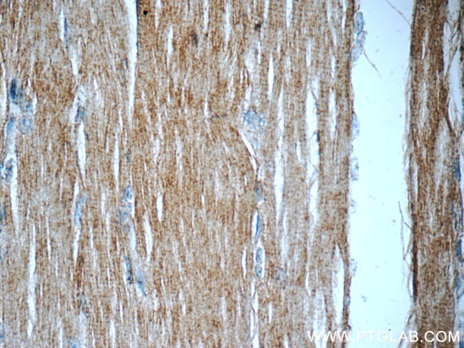 PDK3 Antibody in Immunohistochemistry (Paraffin) (IHC (P))