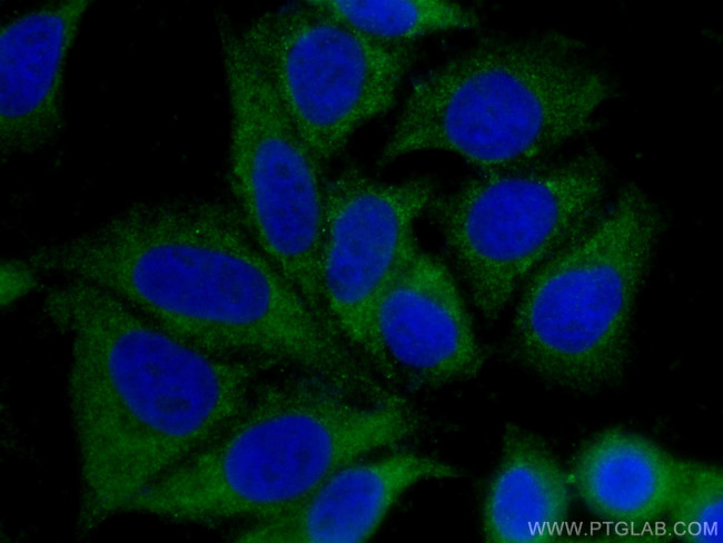 PEPD Antibody in Immunocytochemistry (ICC/IF)