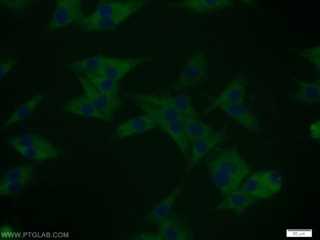 DYNC1I2 Antibody in Immunocytochemistry (ICC/IF)