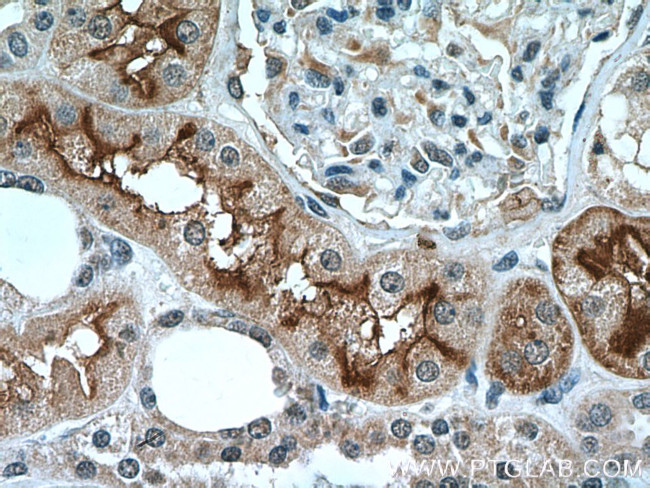 DPEP1 Antibody in Immunohistochemistry (Paraffin) (IHC (P))