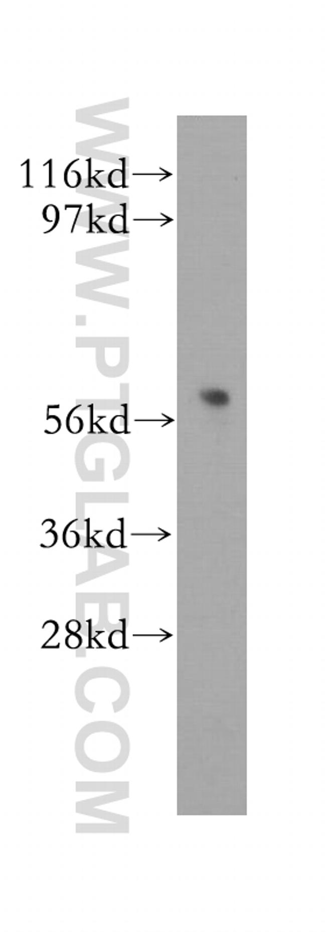 DAK Antibody in Western Blot (WB)