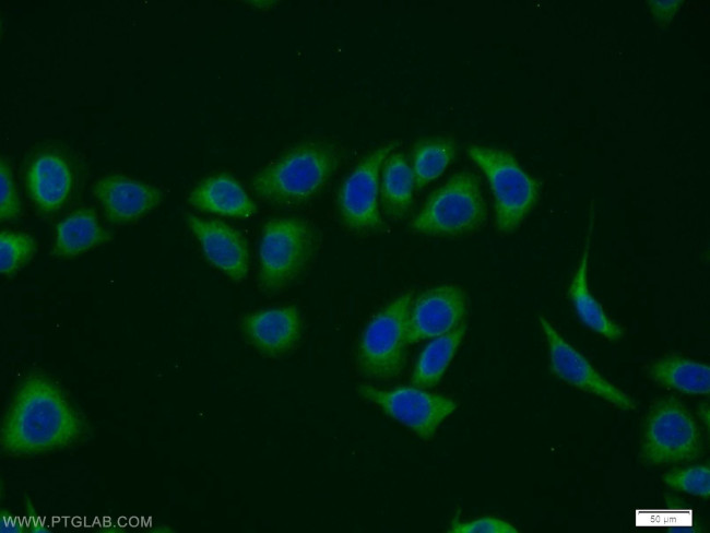 MVK Antibody in Immunocytochemistry (ICC/IF)