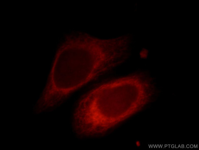 PRKACB Antibody in Immunocytochemistry (ICC/IF)