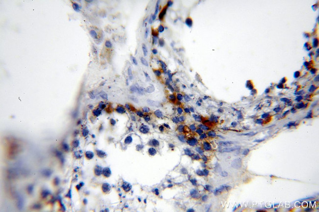 MAGEA1 Antibody in Immunohistochemistry (Paraffin) (IHC (P))