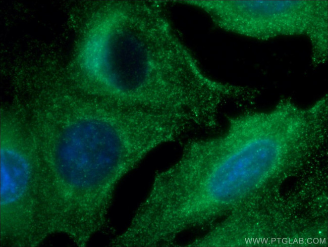 RAB38 Antibody in Immunocytochemistry (ICC/IF)