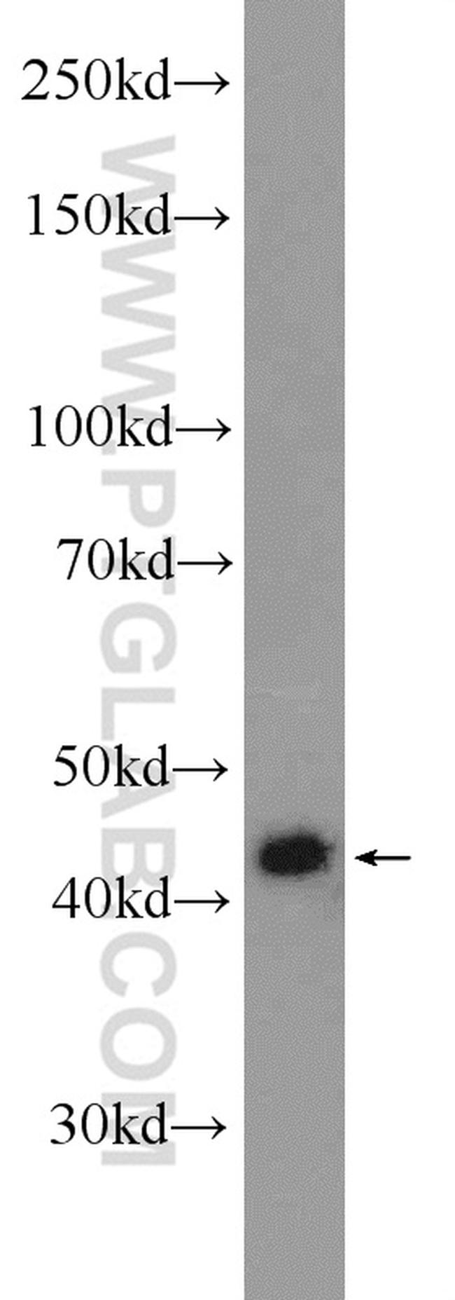 MKRN2 Antibody in Western Blot (WB)