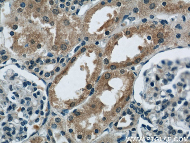 CBY1 Antibody in Immunohistochemistry (Paraffin) (IHC (P))