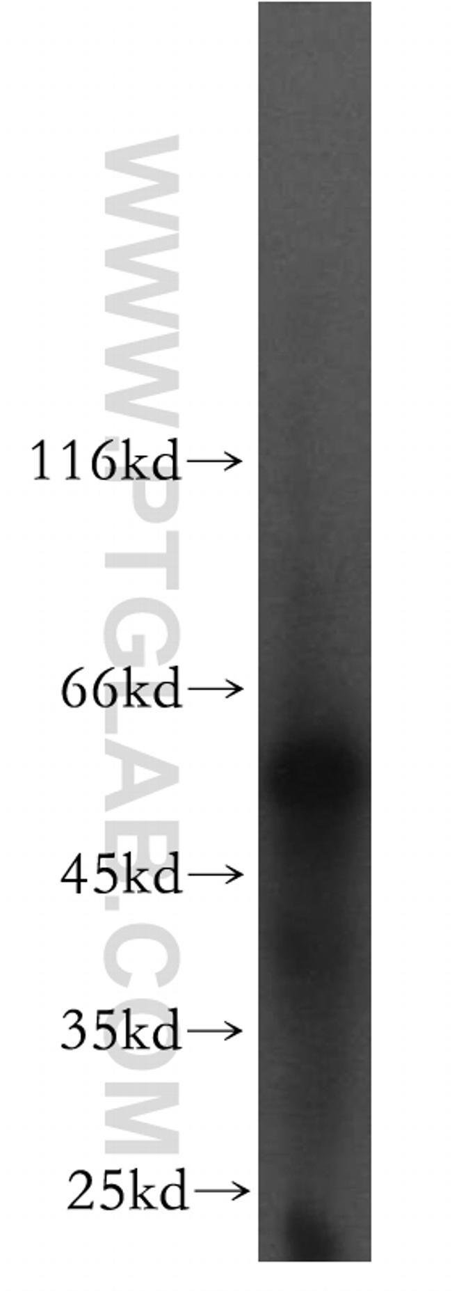 LCAT Antibody in Western Blot (WB)