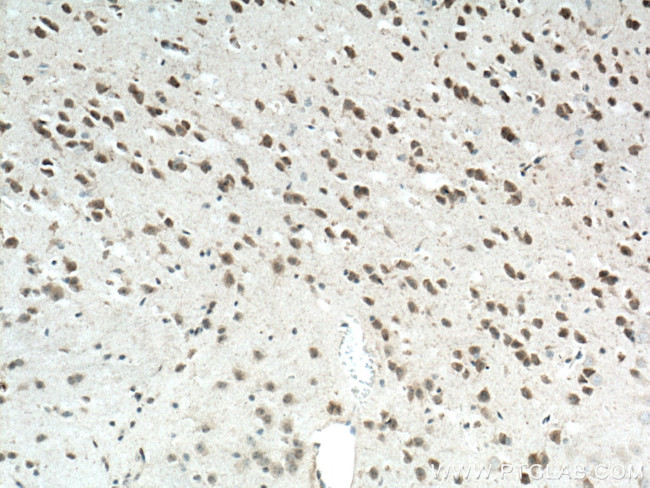 NLRP1 Antibody in Immunohistochemistry (Paraffin) (IHC (P))