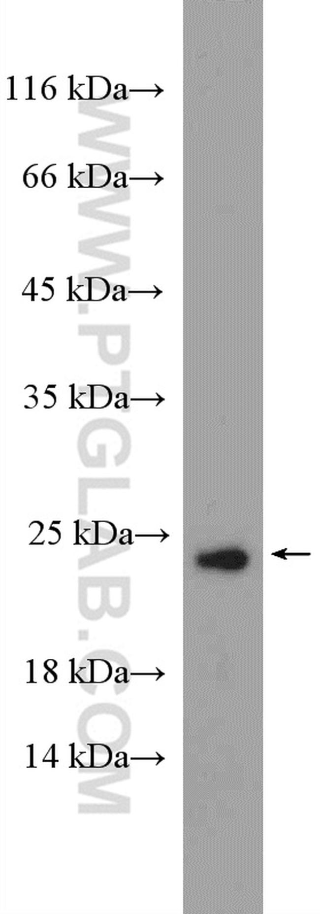 TBPL1 Antibody in Western Blot (WB)