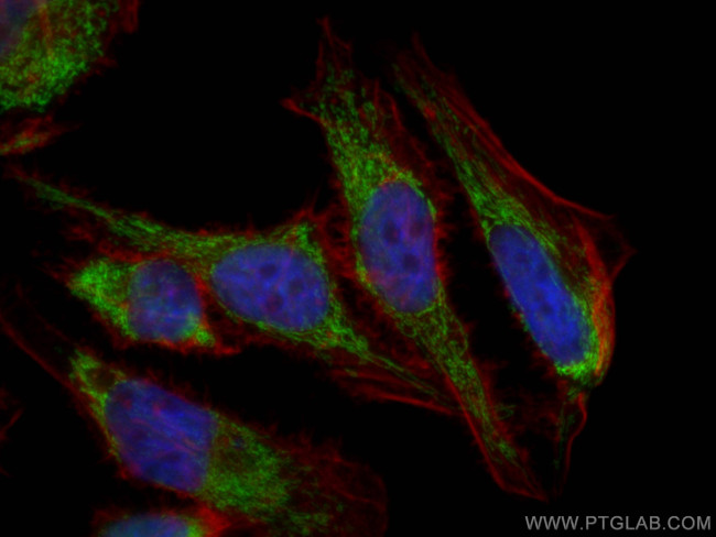 ETFA Antibody in Immunocytochemistry (ICC/IF)