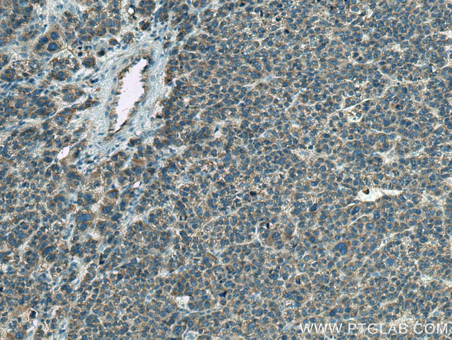 PI16 Antibody in Immunohistochemistry (Paraffin) (IHC (P))