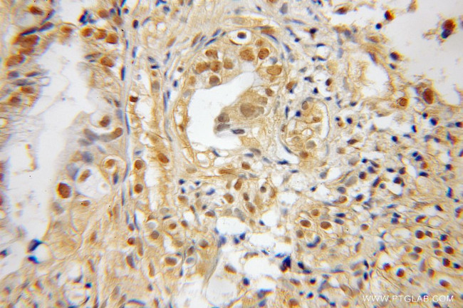 SNX7 Antibody in Immunohistochemistry (Paraffin) (IHC (P))