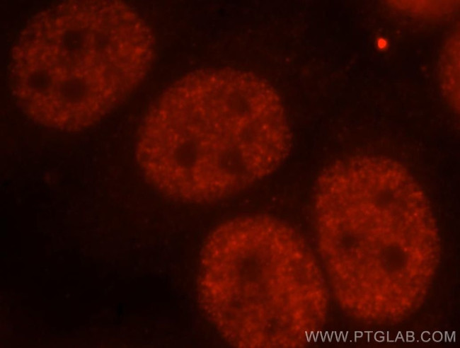FIP1L1 Antibody in Immunocytochemistry (ICC/IF)