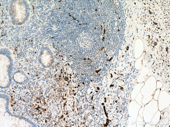 Calretinin Antibody in Immunohistochemistry (Paraffin) (IHC (P))