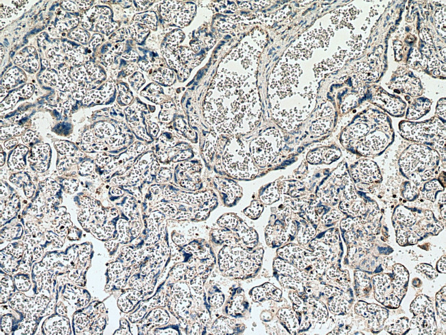 PLAC8 Antibody in Immunohistochemistry (Paraffin) (IHC (P))