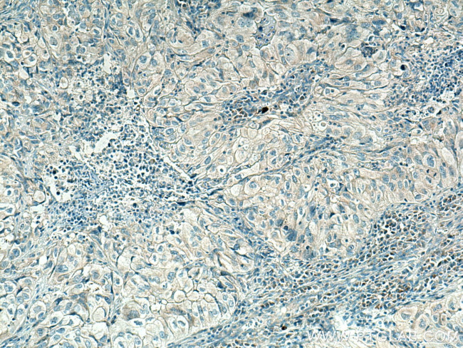 PLXDC2 Antibody in Immunohistochemistry (Paraffin) (IHC (P))