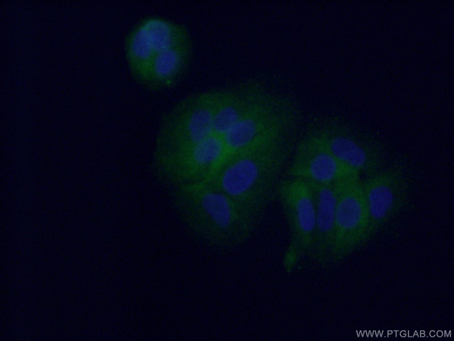 CYP4F11 Antibody in Immunocytochemistry (ICC/IF)