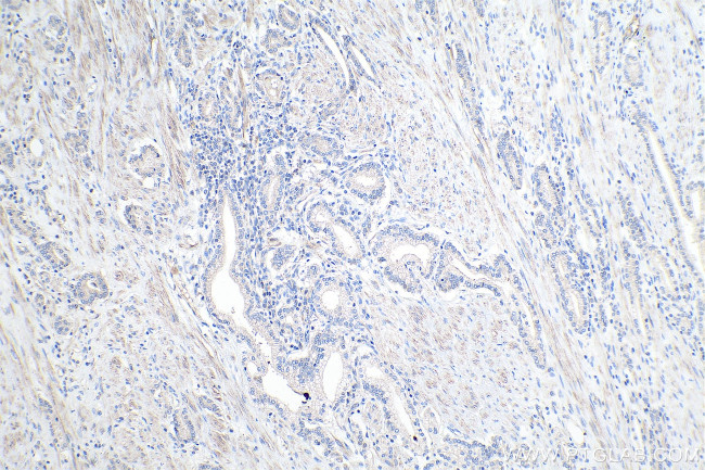 ALKBH3 Antibody in Immunohistochemistry (Paraffin) (IHC (P))