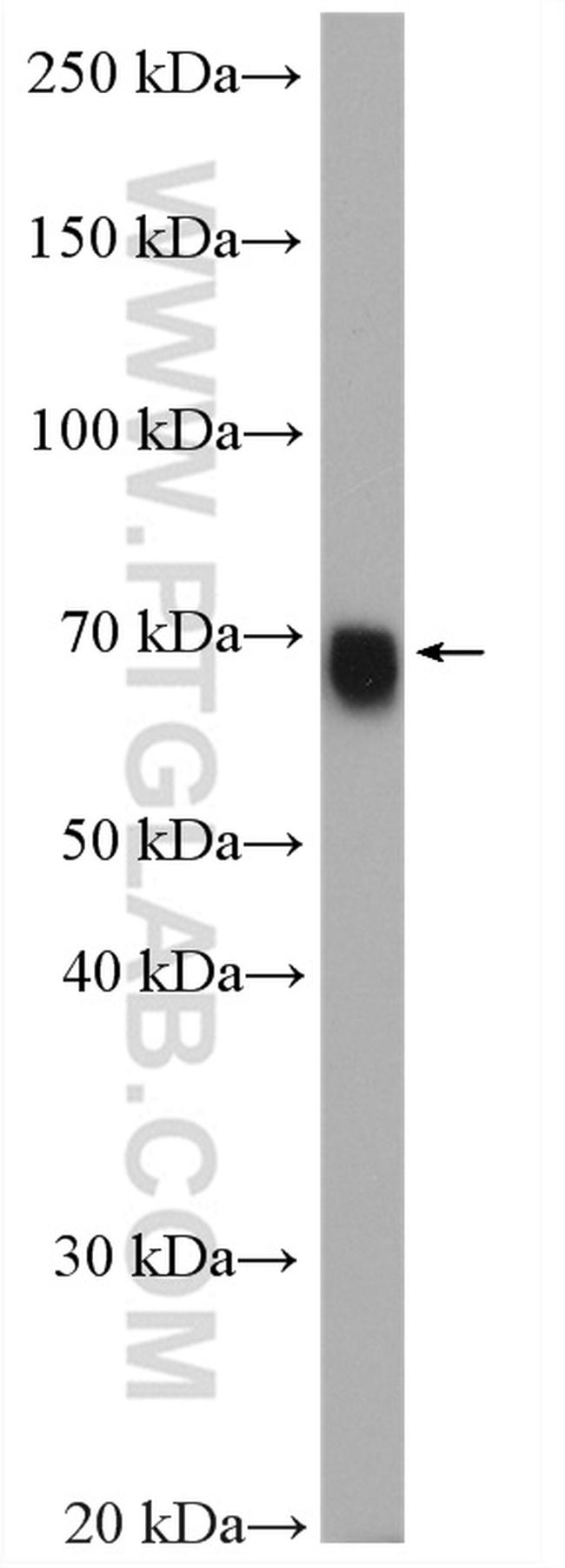 GATAD2A Antibody in Western Blot (WB)